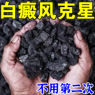 白癜风药膏快速消白斑专用黑色素生长药店同款白癜疯专用特效药