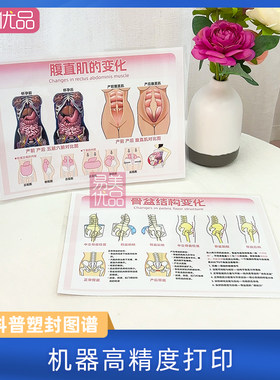 女性产后生理变化妇产科普塑封图谱产康店客户咨询盆底肌腹直肌变