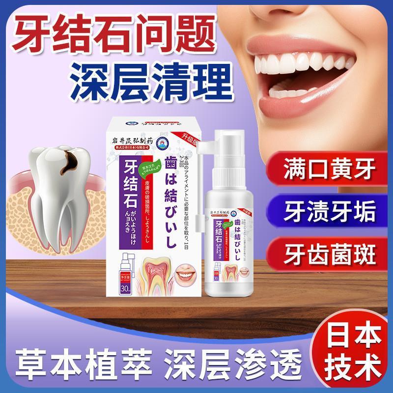 牙结石去除器除口臭牙黄牙垢溶解牙石杀菌速效清理喷雾漱口水神器
