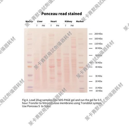 Invent®Na+/K+ATPase ɑ1重组兔单克隆抗体 WB/IHC/ICC/IF/流式
