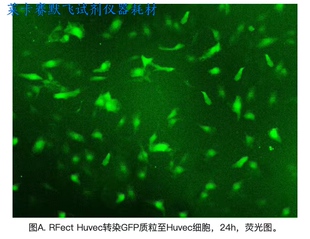 百代RFect Huvec质粒DNA转染试剂套装,优异性能,高效转染内皮细胞