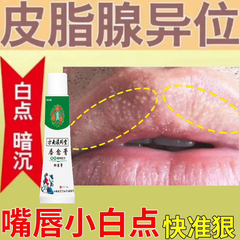 皮脂腺异位症消嘴唇长小白点脂肪小颗粒皮脂腺增生干燥嘴角小颗粒