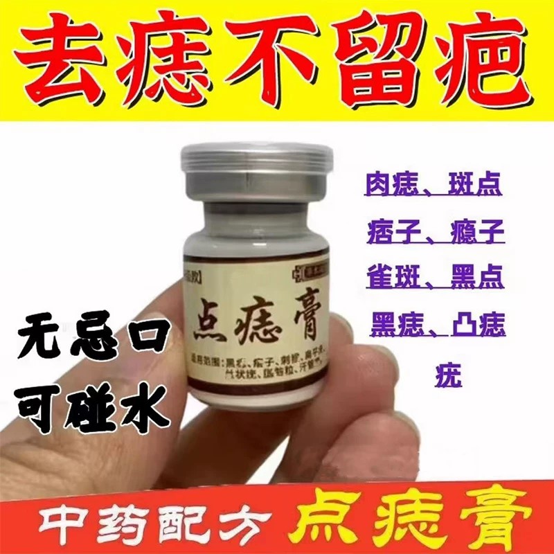 去痣点痣膏脸部专用去痣水志脸部除去黑痣祛取正品药房旗舰店
