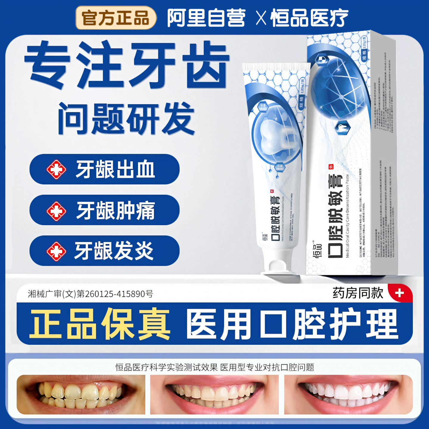 医用口腔护理脱敏膏治疗牙齿过敏