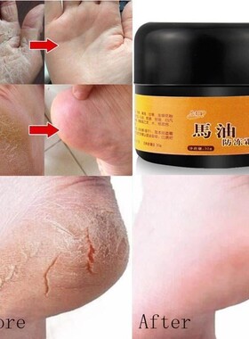 Horse Oil Feet Care Cream Beriberi Cream for Athlete'