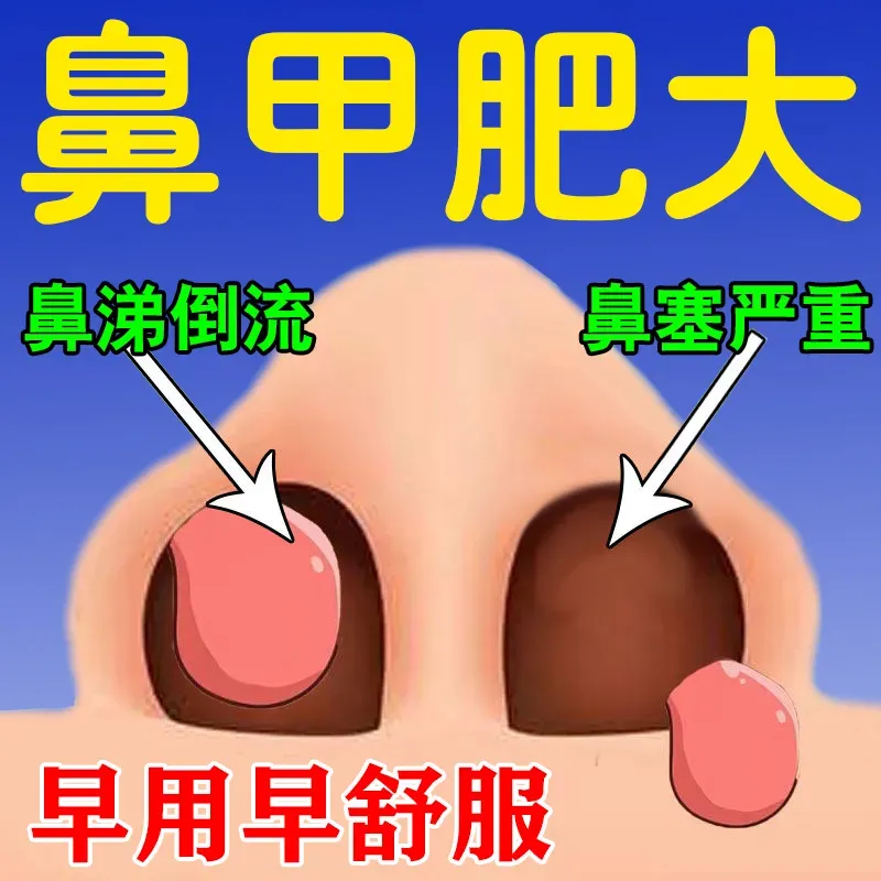 鼻甲肥大专用特效药鼻子不通气神器鼻塞不通气头痛流脓鼻鼻干鼻痒