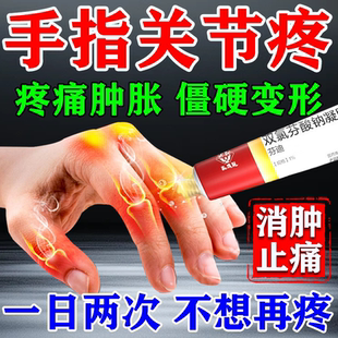 双氯芬酸钠凝胶外用凝胶腱鞘炎导致手指关节疼痛药膏正品腱鞘囊肿