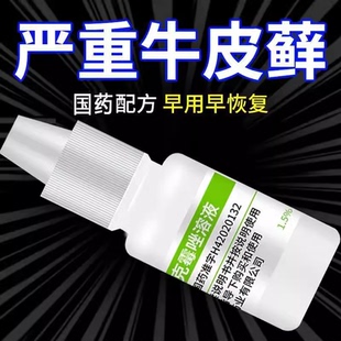 皮肤病癣药水老牌子白云山 克霉唑溶液喷雾剂甲沟炎牛皮癣 手足癣