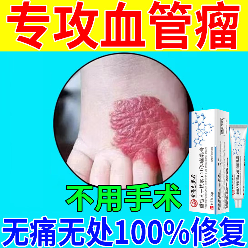 血管瘤婴儿专用药红痣血管痣去除神器蜘蛛痣凝胶药膏修复特效药膏