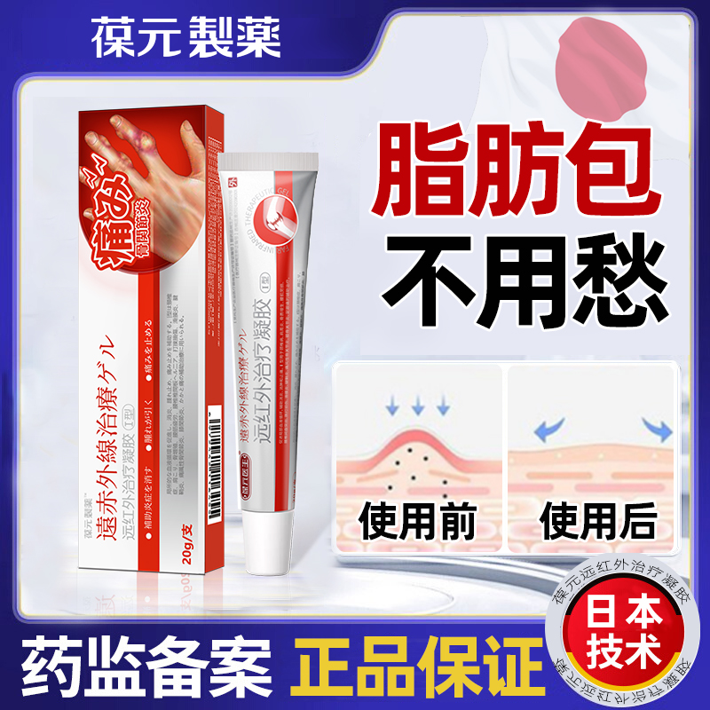 葆元制药远红外治疗脂肪瘤凝胶