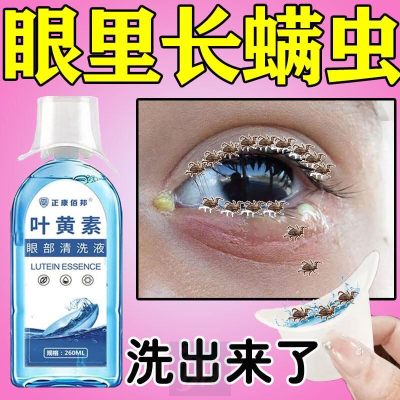眼睛除螨洗眼液干涩发痒眼痒疲劳模糊去红血丝叶黄素眼部清洗液