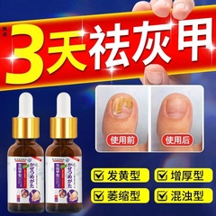 灰指甲抑菌液日本进口药膏水凤仙花脱甲精油冰醋酸涂剂一滴净正品