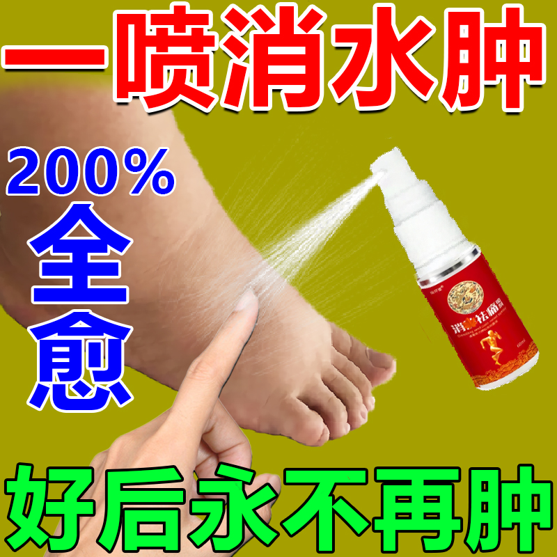 消脚肿水肿专用老人去下肢小腿部水肿浮肿利尿排水的神