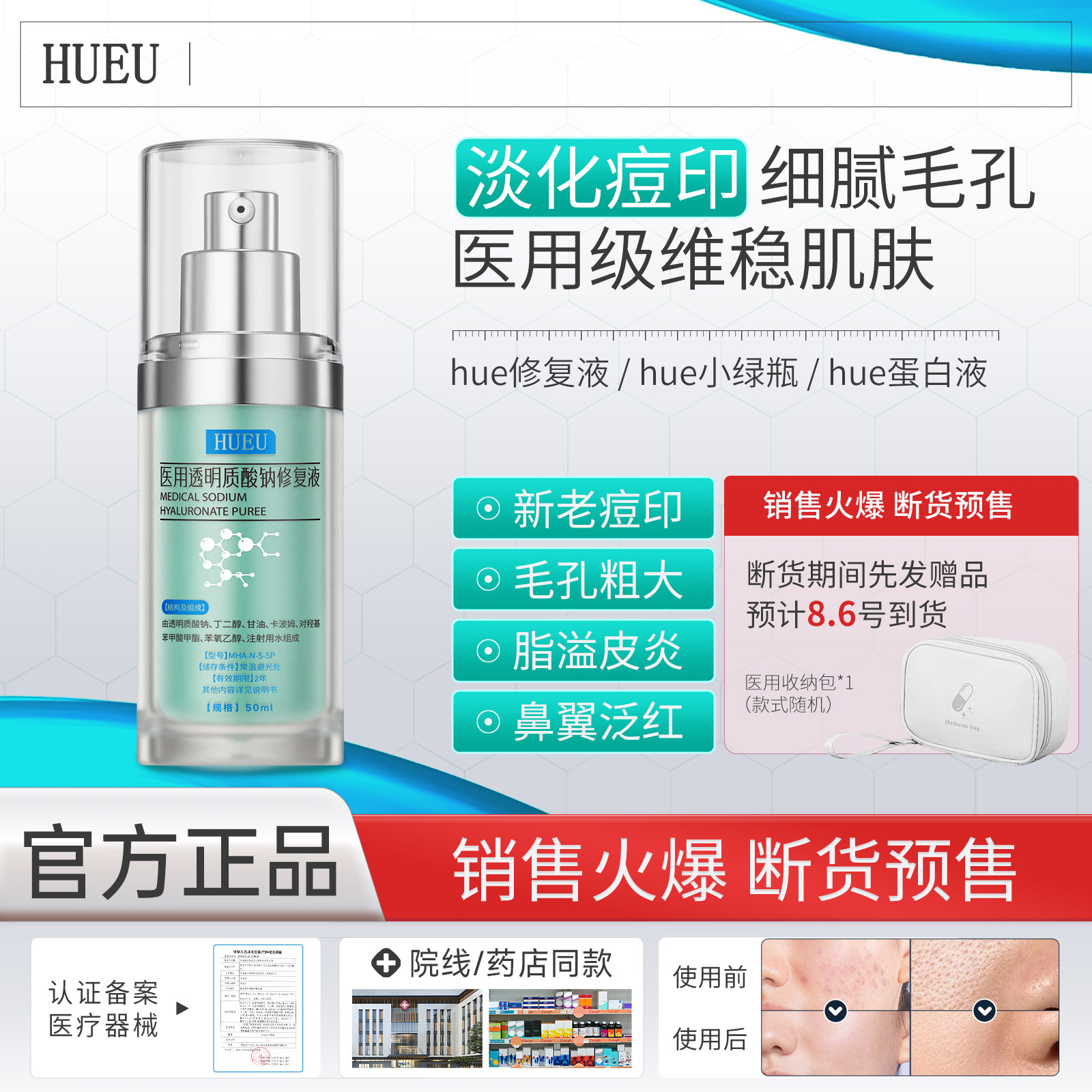 hue修复液小绿瓶蛋白液医用级去痘印收毛孔细腻肌肤