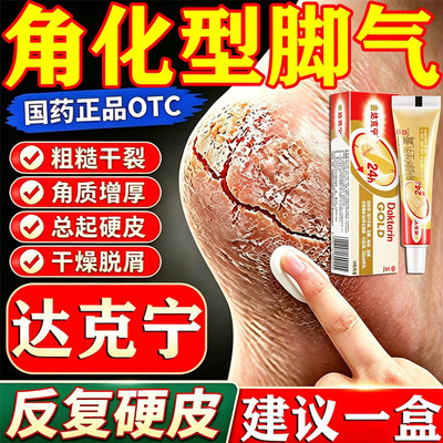 金达克宁酮康唑乳膏正品止痒脱皮脚气专用药膏酮康唑软膏脚气喷雾