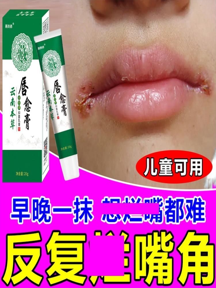 云南本草唇愈膏唇膏儿童嘴唇干裂脱皮干燥保湿滋润起泡烂嘴角修复,美容护肤/美体/精油,润唇膏,淘宝优惠券,粉丝福利购,淘宝优惠卷