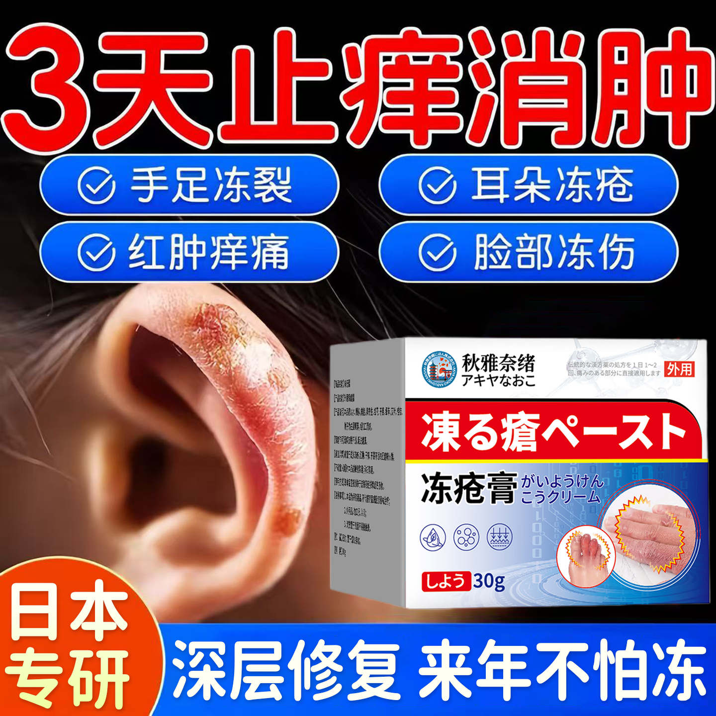 日本冻疮膏止痒冻伤膏正品医用