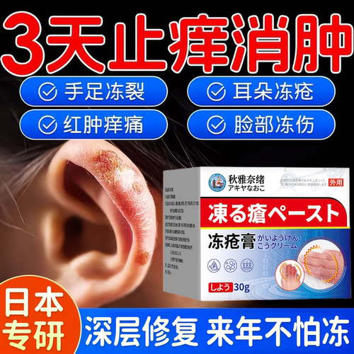 日本冻疮膏止痒冻伤膏正品医用