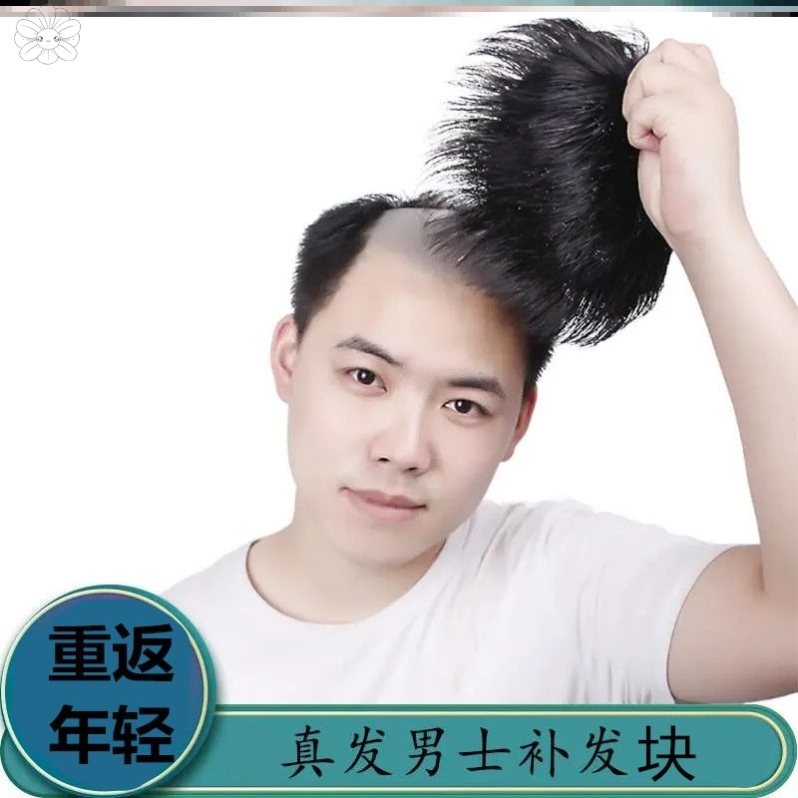 前额补发男士发际假发套头线秃顶假发男式顶头套补发发全假片男式