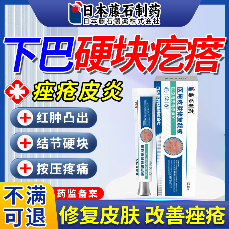 下巴痤疮结节硬块痘脸用疙瘩