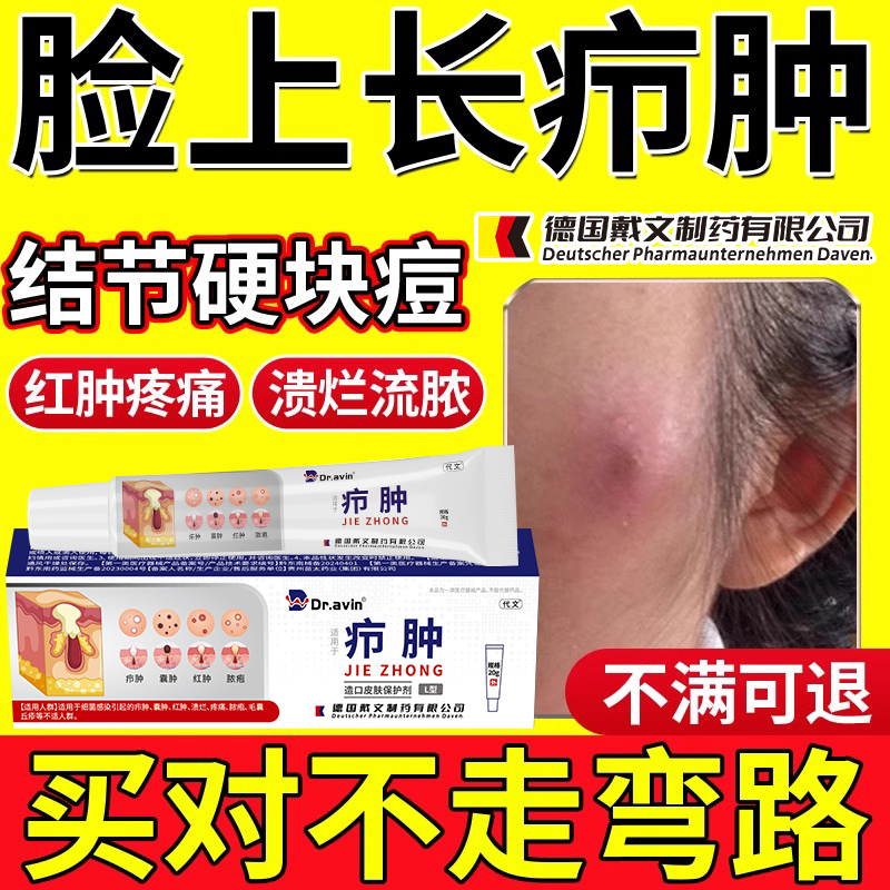 【天猫正品】疖肿拔毒膏