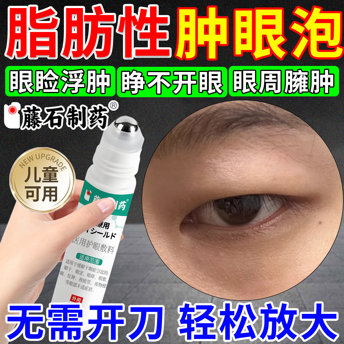 上眼皮脂肪型厚去肿眼泡消除神器眼睑肌无力浮肿水肿眼部凝胶xu
