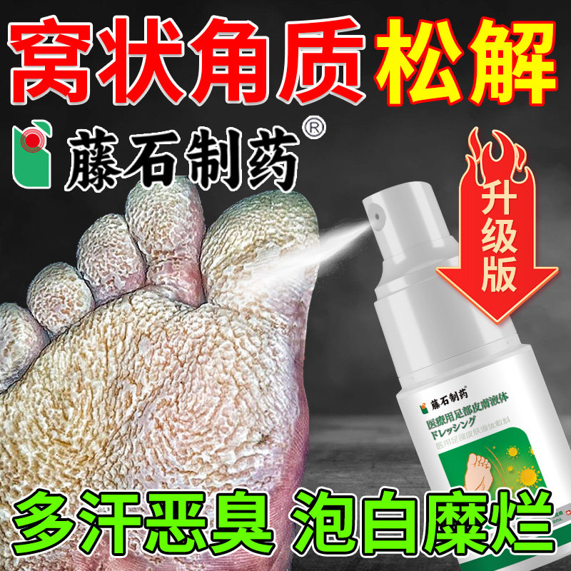 窝状角质松解懈症专用真菌感染水泡出汗臭脚气底蜂窝状沙虫喷剂xu