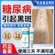 藤石制药糖尿病引起小腿黑斑去糖斑除胫前皮肤痒色素沉着烂足膏xu