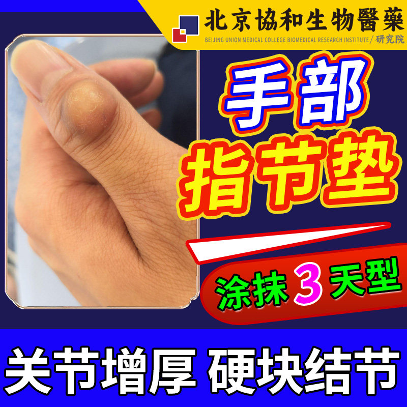 指节垫专用手指关节癣真菌感染增厚凸起硬块脱皮干裂可搭膏药贴vb