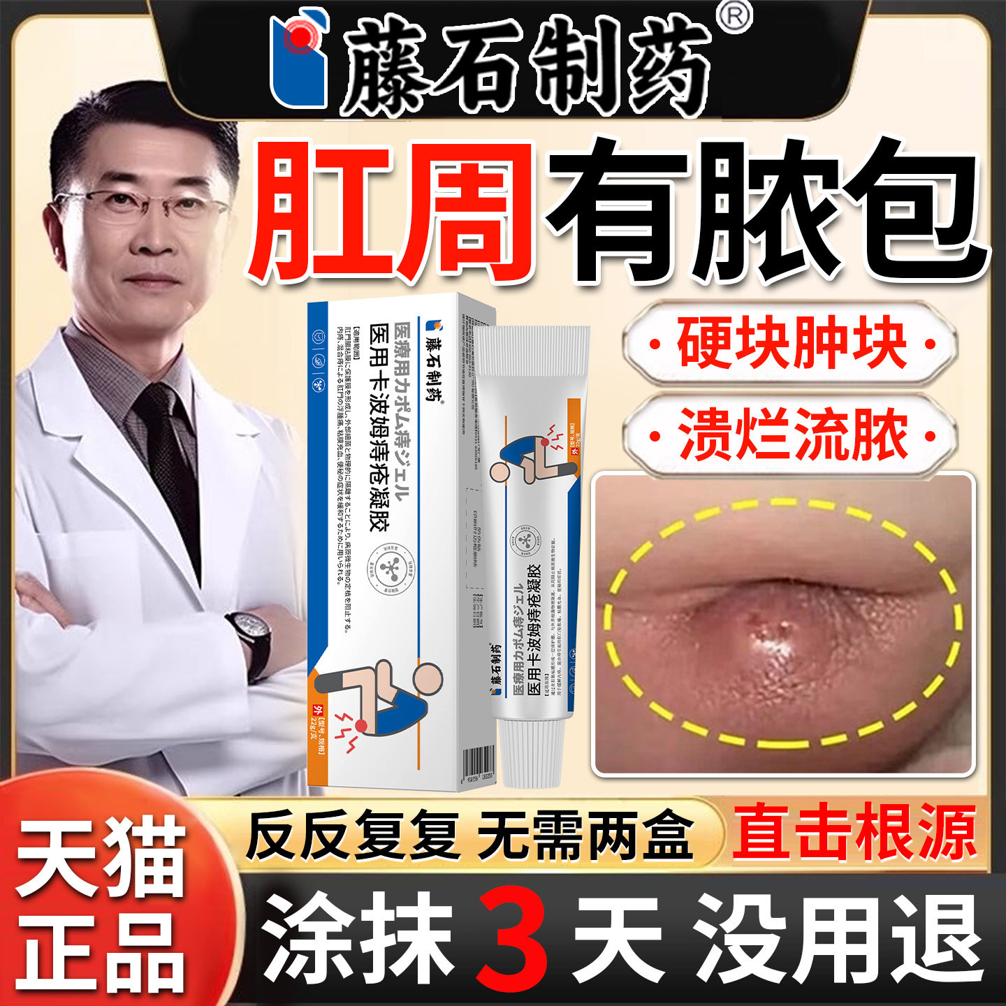 肛周脓肿特药监备案效物肛瘘肛门硬块坐浴药包膏术后引流条消炎xu