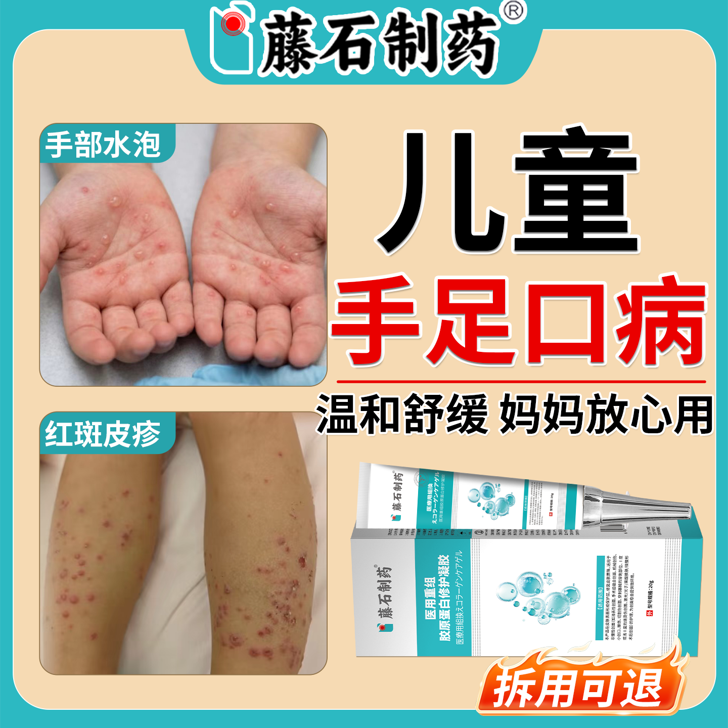 儿童手足口病红斑疱疹水泡病毒性感染皮肤修复凝胶药房同售OM