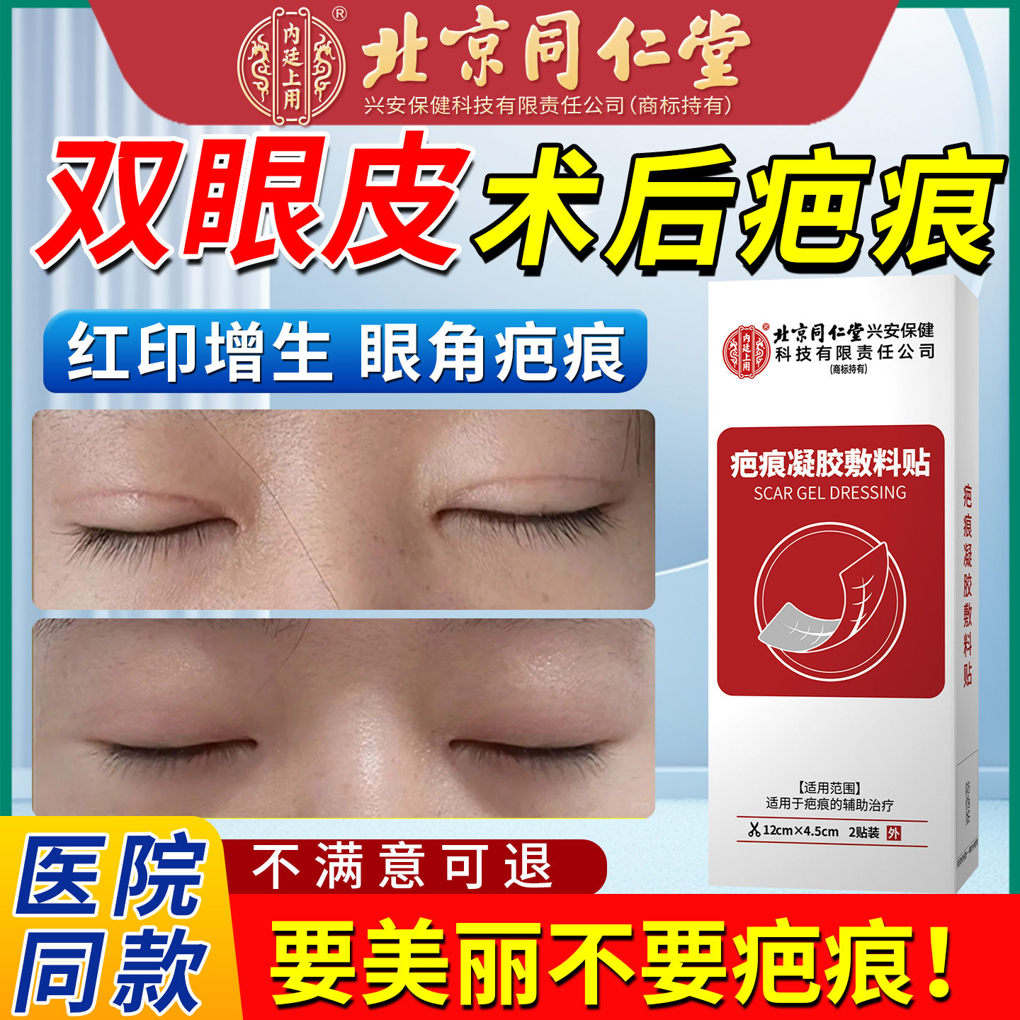 双眼皮术后疤痕修复医用硅酮祛疤贴开眼角遮盖增生淡化神器贴xu