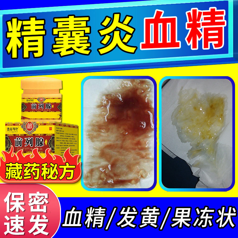 精囊炎血精症专用前列腺附睾丸炎脲频急疼痛精液带血非膏药贴vb