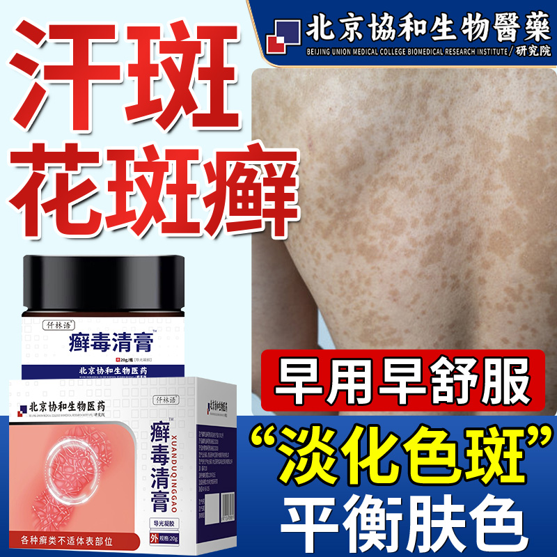 汗斑花斑癣专用前胸后背腋下淡化色斑点用净皮肤褐斑可搭膏药贴vb