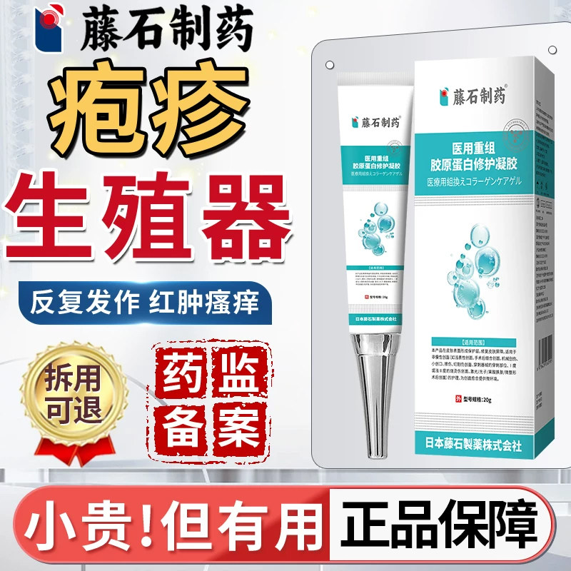 藤石制药生殖器疱疹断疗口进根防复发男女真菌感染泡疹用什么OA