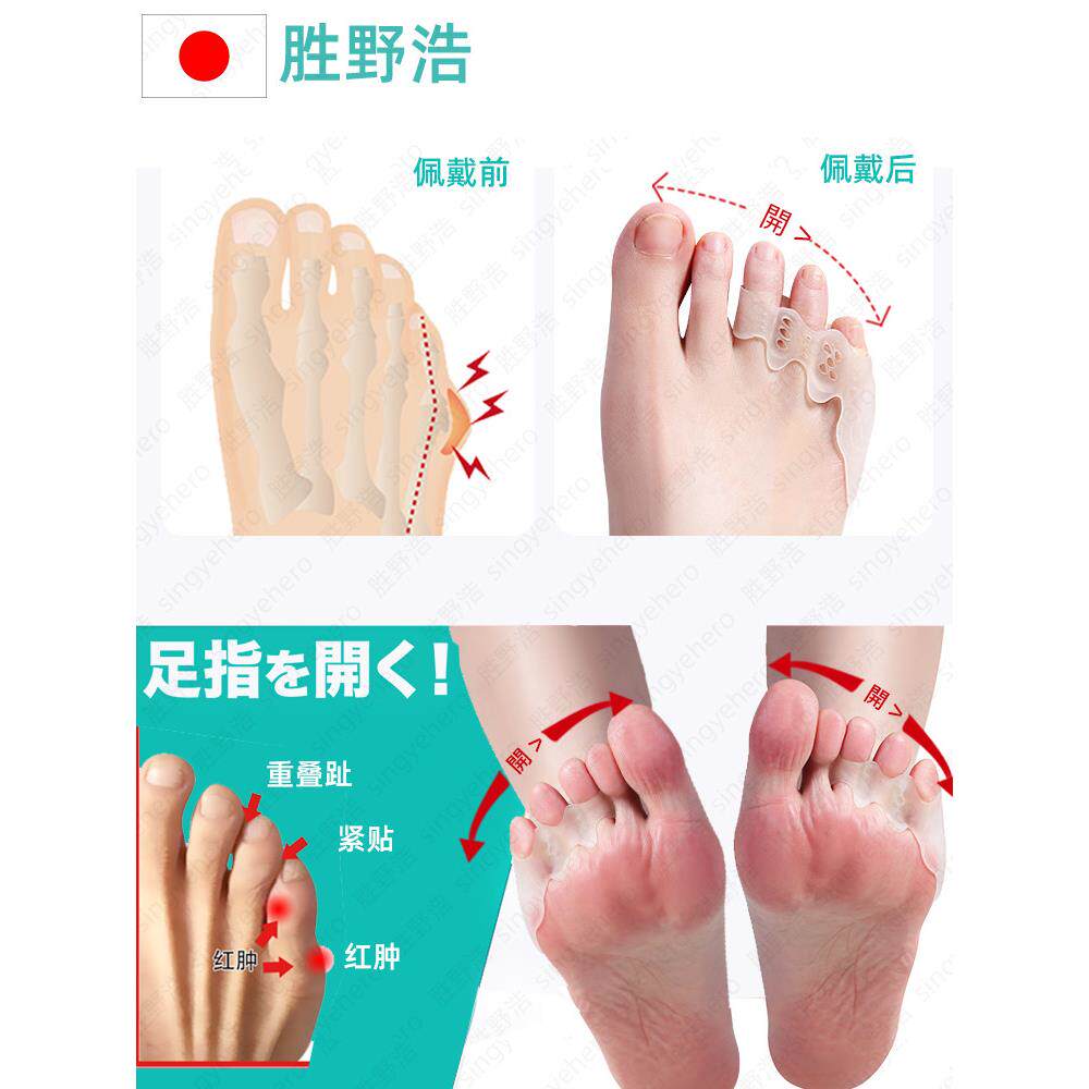 指日本小脚内外翻防磨矫正器小拇离555趾分器硅胶保护套趾可穿鞋