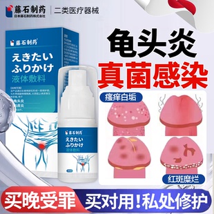 医用男性念珠菌性包皮炎龟头炎症真菌感染私处专特用效药膏喷雾LJ
