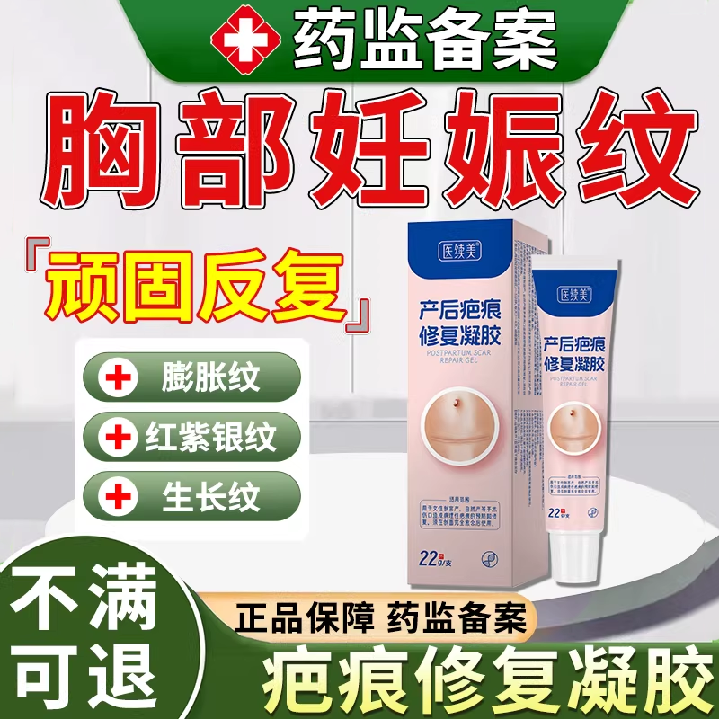 胸部淡化纹妊娠纹青少年生长纹大腿学生可搭膏药贴祛去CS