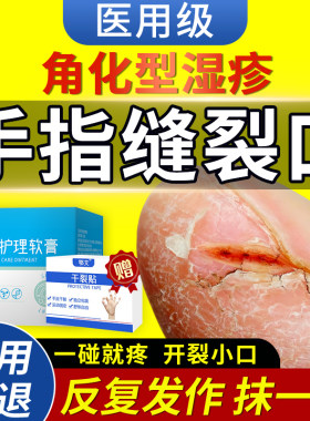 手指头缝裂口【反复发作】