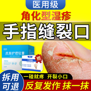 指甲边缘裂口手指头裂口子脱皮开裂干裂愈合膏药膏手指尖防皲裂QQ