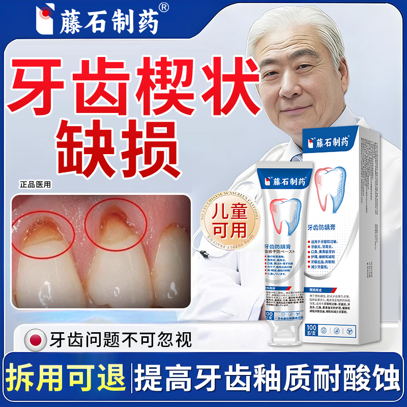 牙根牙釉质腐蚀牙齿烂洞修复液楔状缺损修补敏感修护凝胶搭牙膏CS