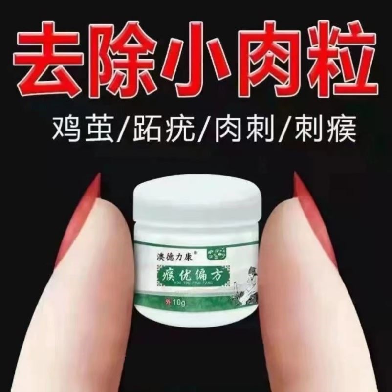 无痛去疣灵肉刺瘊子猴子祛除神器治疗肉粒疙瘩刺猴小肉粒丝状疣身
