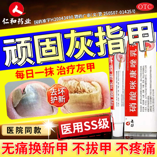 灰指甲专用药正品旗舰店甲沟炎治疗真菌感染脚气脚后跟干裂药膏QK