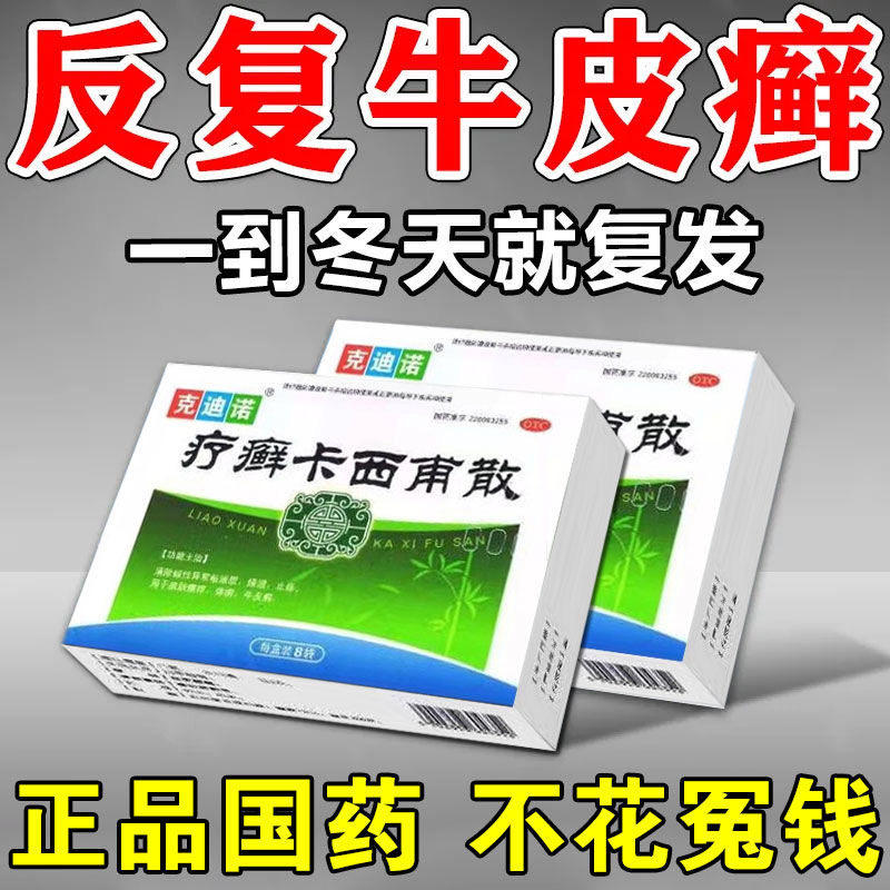 克迪诺疗癣卡西甫散治牛皮癣银屑病口服药皮肤瘙痒止痒反复发作
