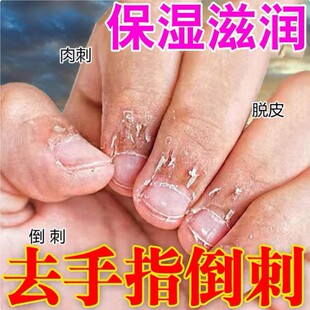 手指起倒刺修复受损儿童成人手上干裂脱皮去死皮肉刺疼专用护手霜