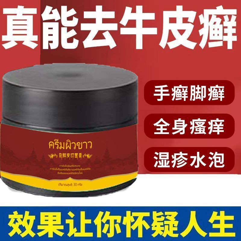 抖音同款泰国御灵花白鲜皮抑菌膏皮肤头皮癣银屑止痒湿疹浮肿正品