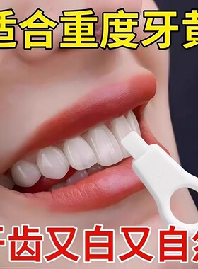 洁牙擦儿童牙齿牙菌斑祛除