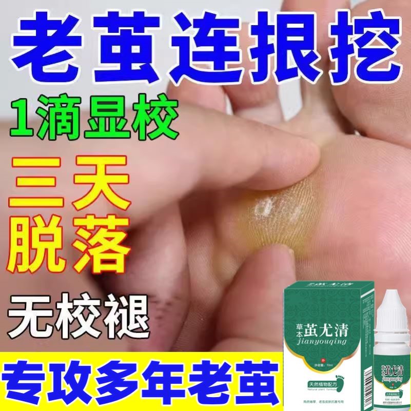 脚底去老茧去除手茧软化剂死皮脚垫去老茧脚茧脚皮膏脚底老茧硬皮