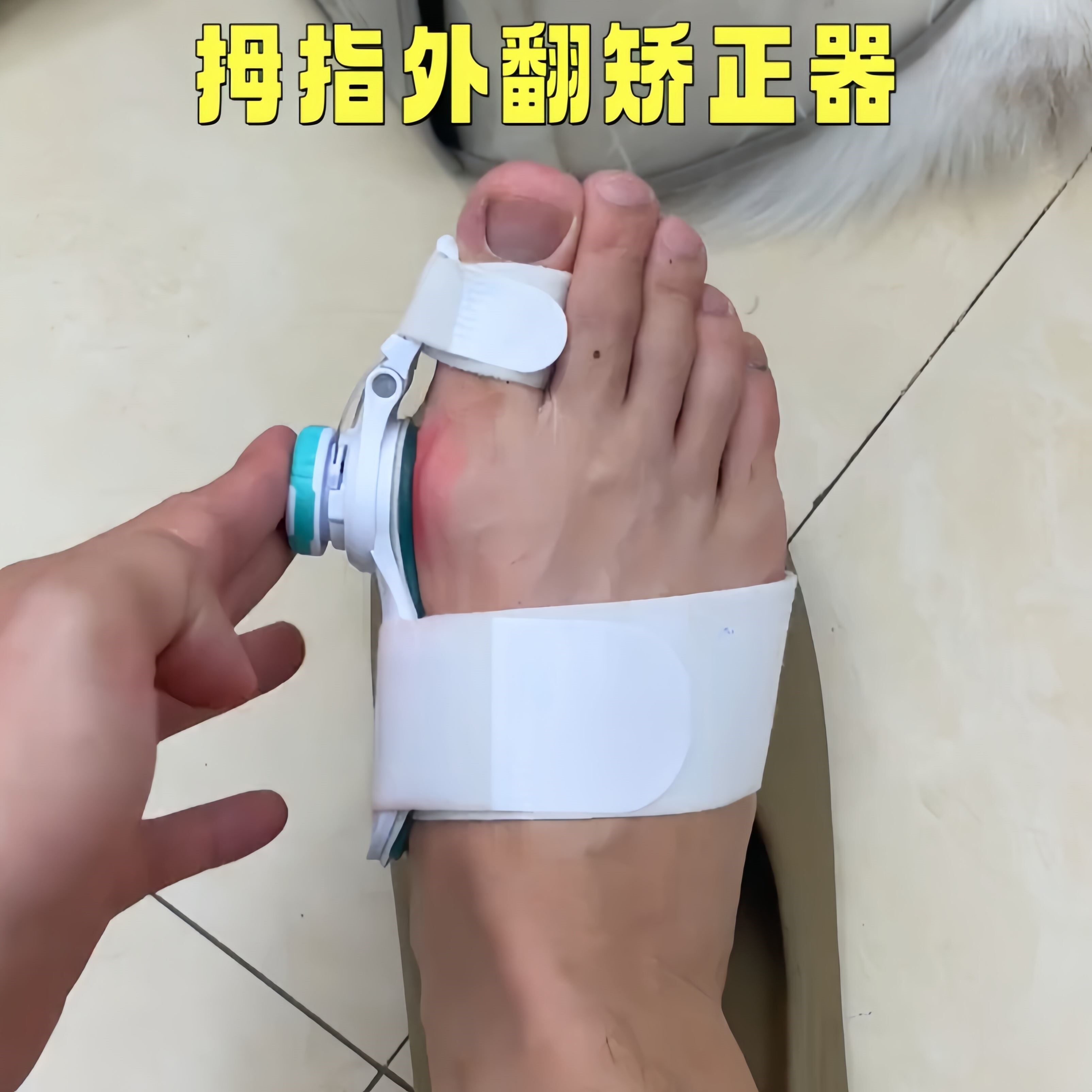 拇外翻矫正器女士可调节大母脚趾分趾器脚骨突出矫正器脚趾头矫形