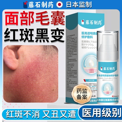 儿童可用脸颊有小疙瘩鸡皮肤